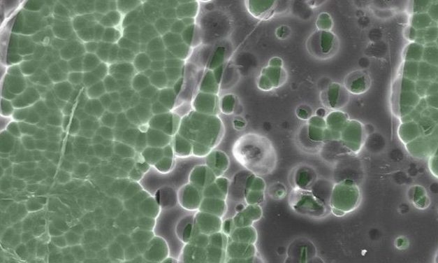 Mutant enzyme that eats plastic bottles