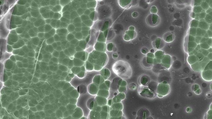 Mutant enzyme that eats plastic bottles